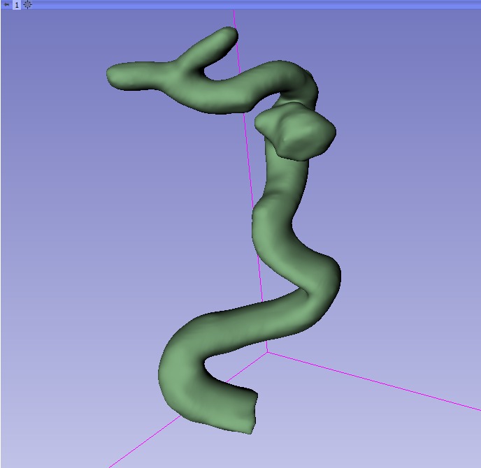 USP cria projeto que simula cirurgia craniana com impressão 3D e