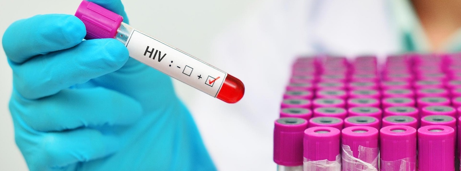  OMS lança diretrizes de testagem para ampliar tratamento de HIV