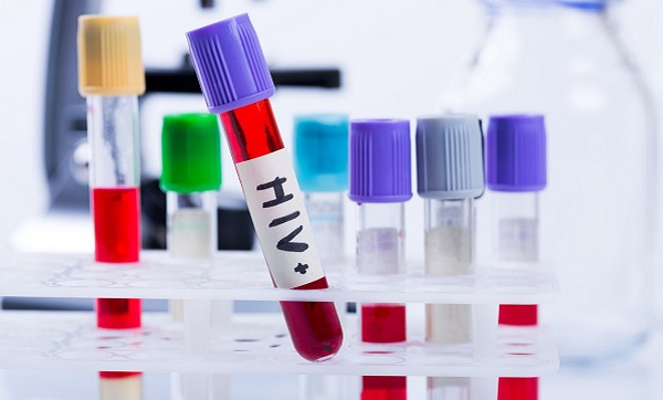  AHF Brasil e CRT-SP oferecem testes gratuitos de HIV
