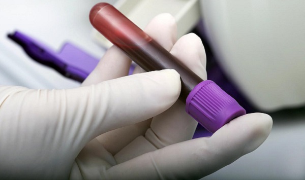  Testes rápidos de HIV, sífilis e hepatites são tema de curso oferecido pela USP