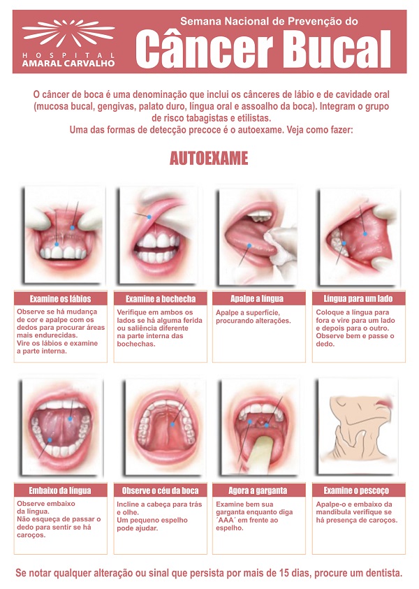Cancer bucal sintomas. Subiecte în Cancer Cancer bucal sintomas