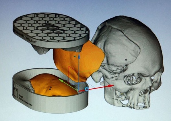 USP cria projeto que simula cirurgia craniana com impressão 3D e