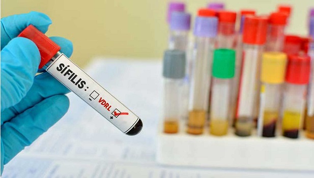  Moinhos de Vento e Ministério da Saúde lançam projeto para combate à sífilis