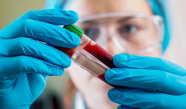 IBCC Oncologia incorpora metodologia da OMS que preserva sangue do paciente em transplantes