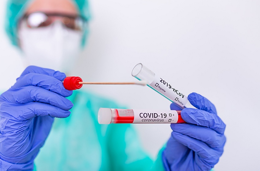  Hermes Pardini realizou mais de 100 mil testes PCR da Covid