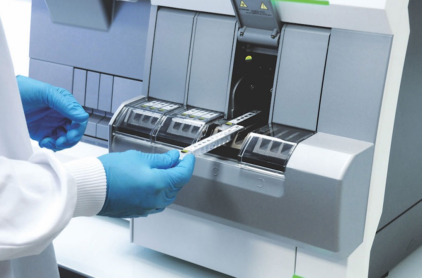  Covid: Teste detecta separadamente anticorpos IgM & IgG em 27 minutos