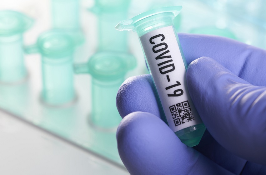  Dados mostram que 20% dos testados por PCR são portadores da Covid