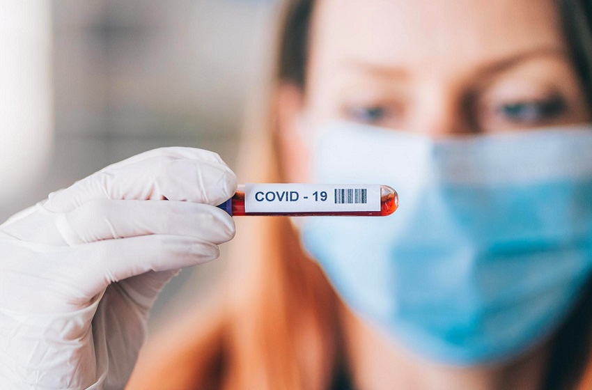  CR Diagnósticos registra aumento de 35% em testes para Covid