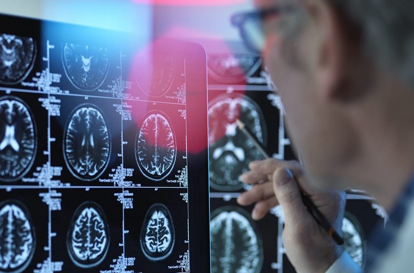  Estimulação cerebral pode ser alternativa para tratar TOC
