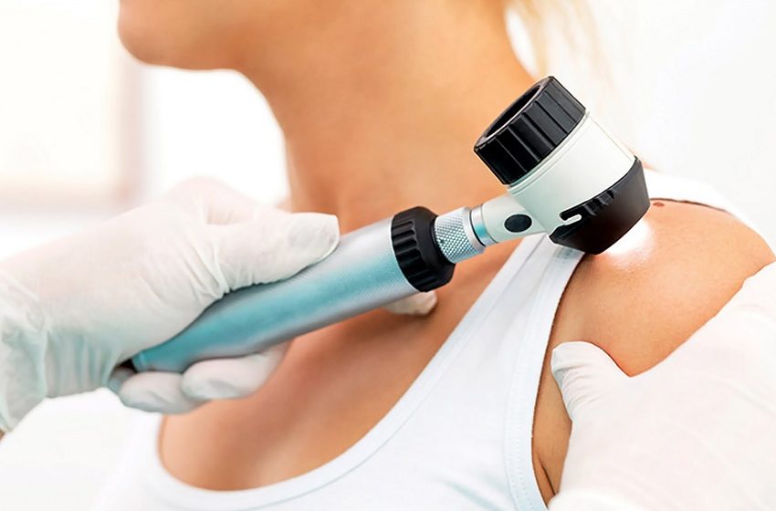  Tecnologia para tratar câncer de pele é aprovada para uso no SUS