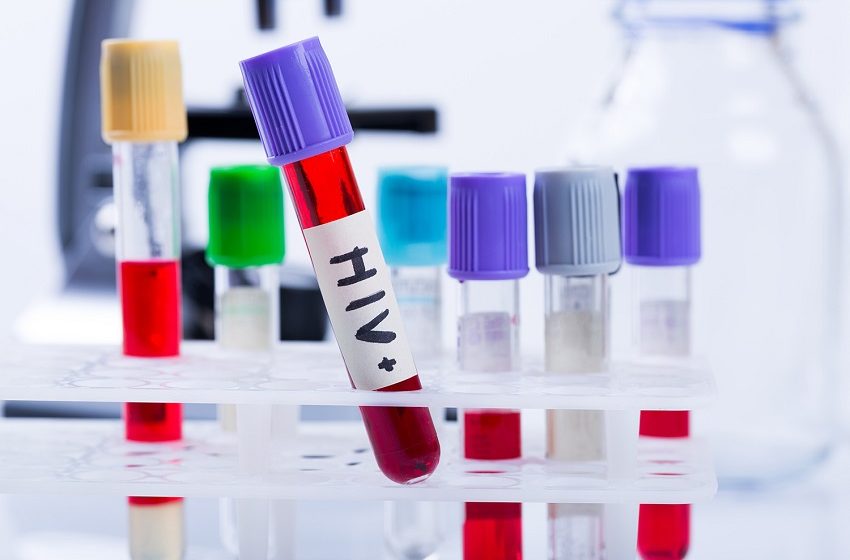  Ministério da Saúde distribui novo medicamento para pacientes com HIV