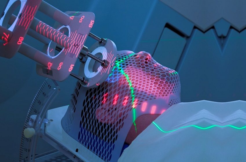  Para evitar apagão na Radioterapia, 530 aparelhos serão necessários em 2030