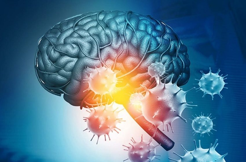  Estudo aponta sequelas neurológicas em pacientes leves de Covid-19