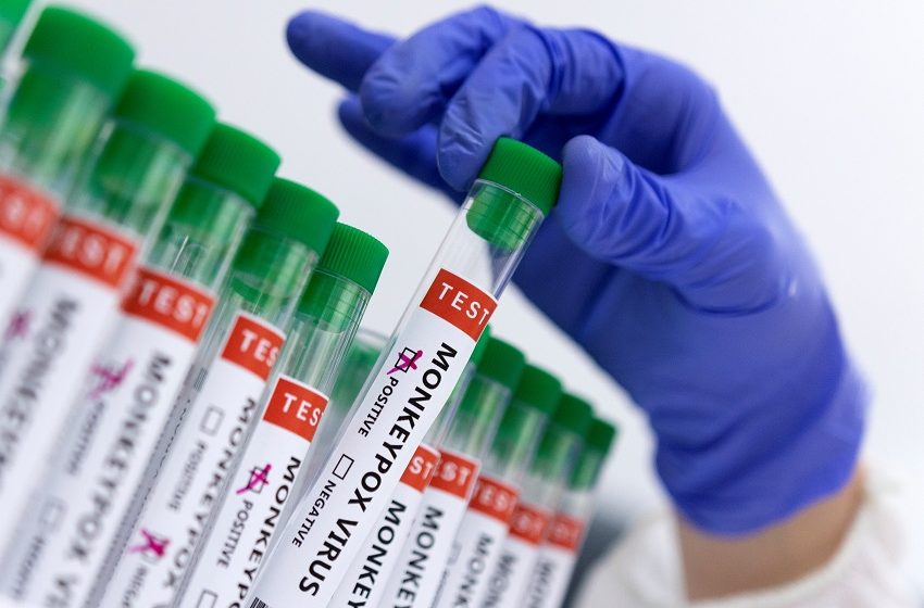  Elsevier lança centro de informações gratuito sobre varíola do macaco