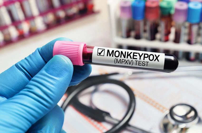  Notificação de casos da varíola dos macacos passa a ser obrigatória