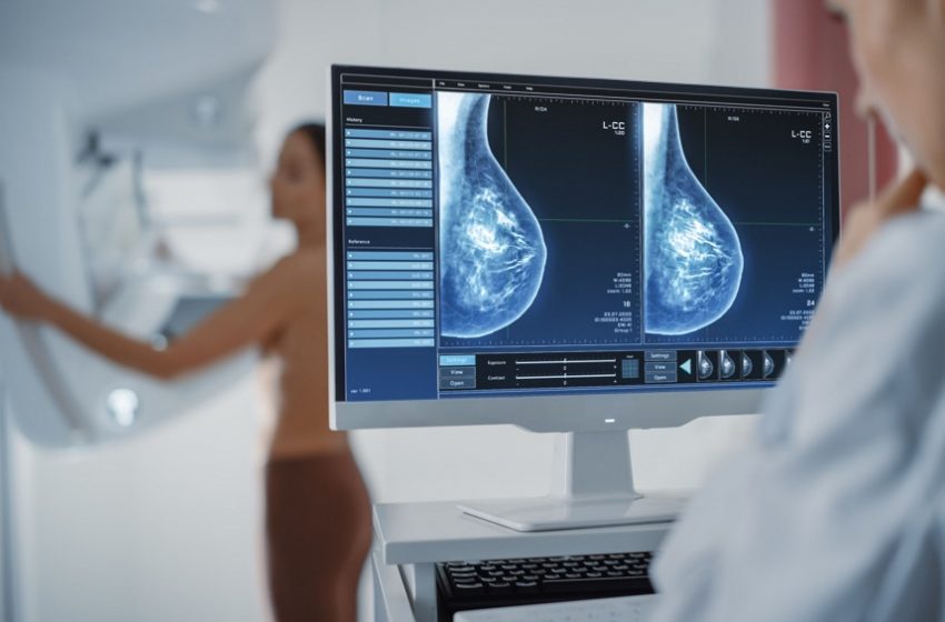  Cobertura de mulheres que fazem mamografia está muito abaixo do recomendado