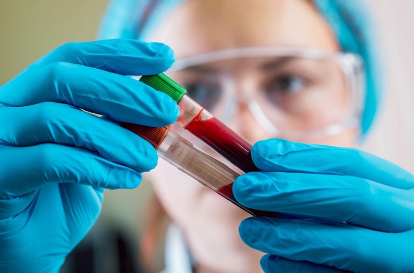  Como um exame de sangue pode inovar o rastreamento do câncer