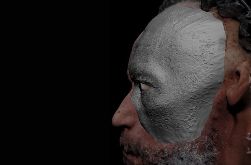  Hospital de Amor reabilita pacientes com prótese facial moldada em 3D