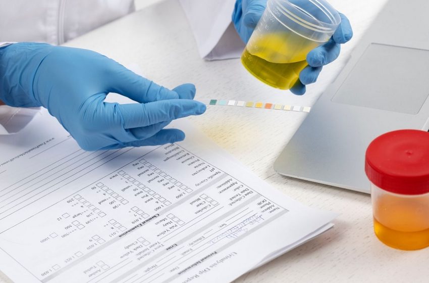  AFIP lança primeiro teste de tolueno na urina realizado no Brasil