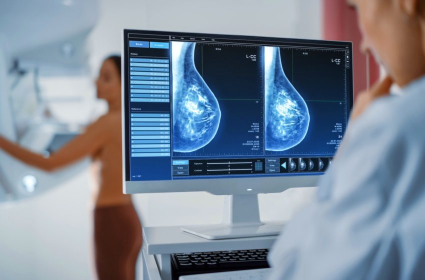  Parceria entre Hospital de Amor e Siemens amplia o acesso ao diagnóstico do câncer de mama