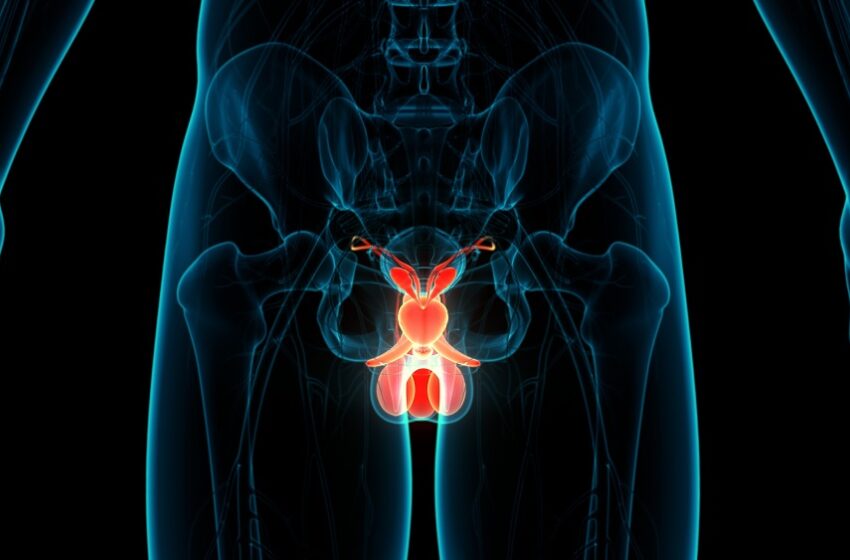  Anvisa aprova primeira terapia alvo radioligante para câncer de próstata