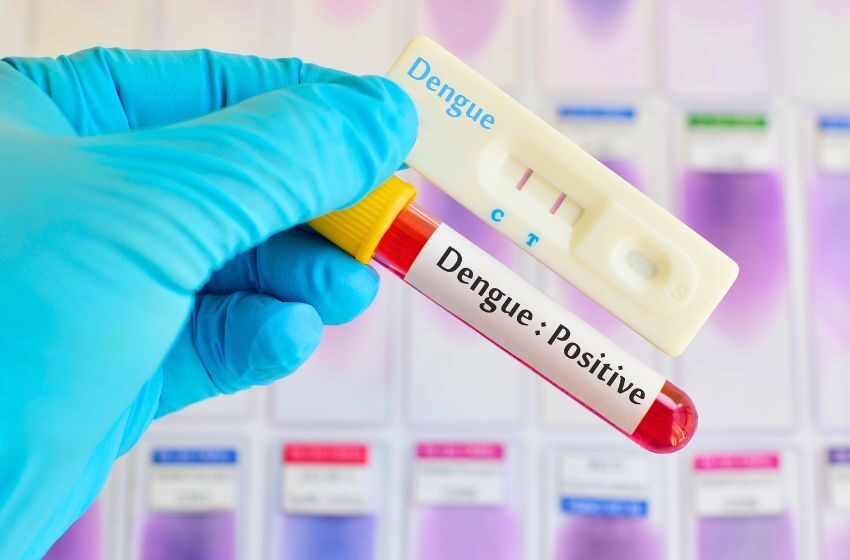  Cresce 21% o número de exames de dengue realizados na rede privada