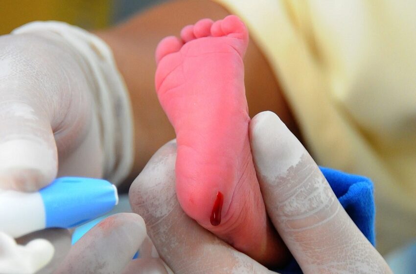  Somente 48% dos brasileiros já ouviram falar de triagem neonatal