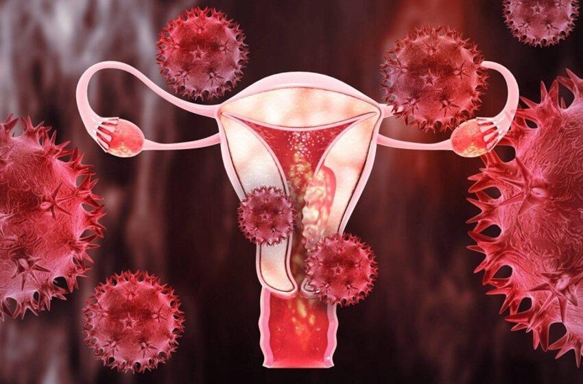  Mayo Clinic desenvolve teste caseiro com swab para cânceres de endométrio e de ovário