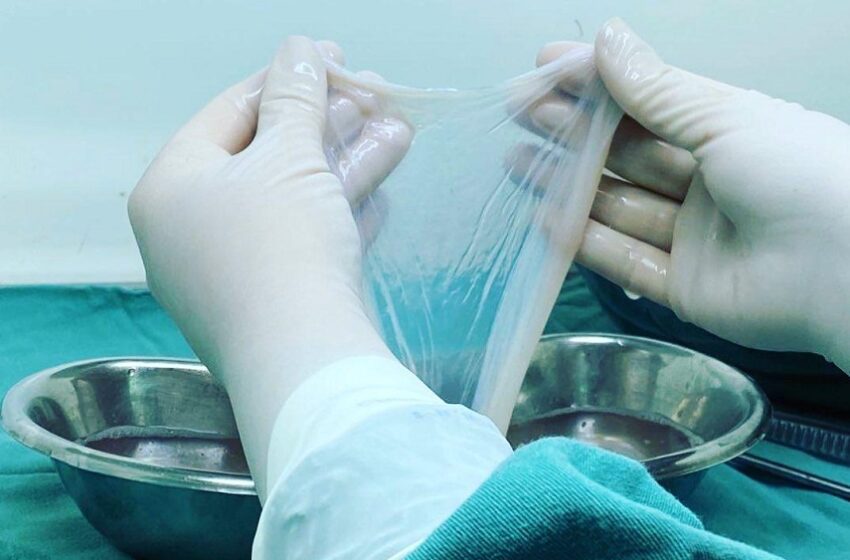  Membrana amniótica é aprovada para tratamento de queimados pelo SUS