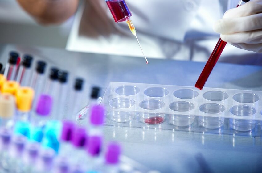  Fiocruz vai ampliar produção de kits diagnósticos para o SUS