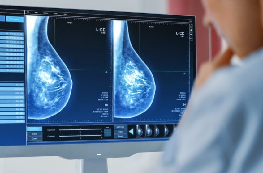  Pesquisadores da USP criam tomógrafo de mama por ultrassom