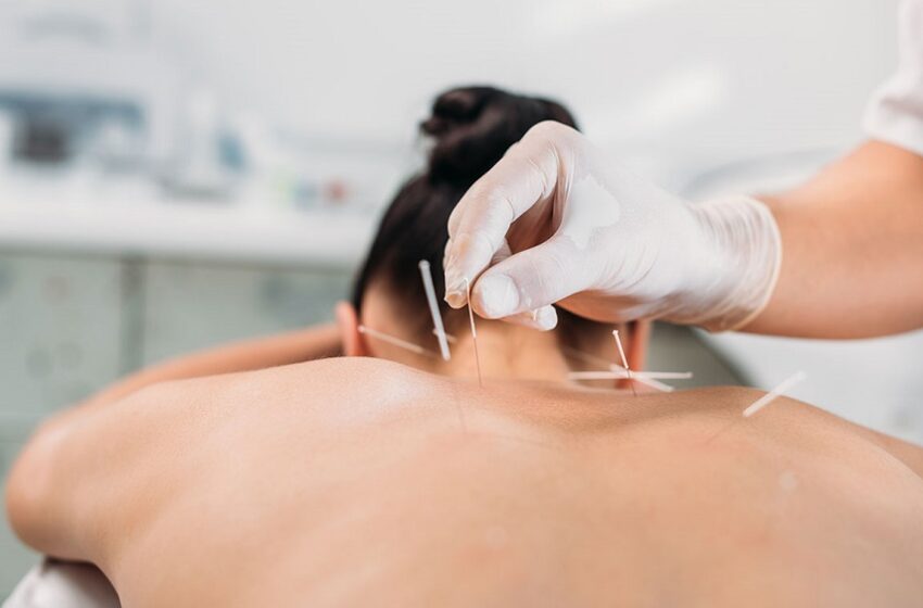  Lei regulamenta exercício profissional da acupuntura