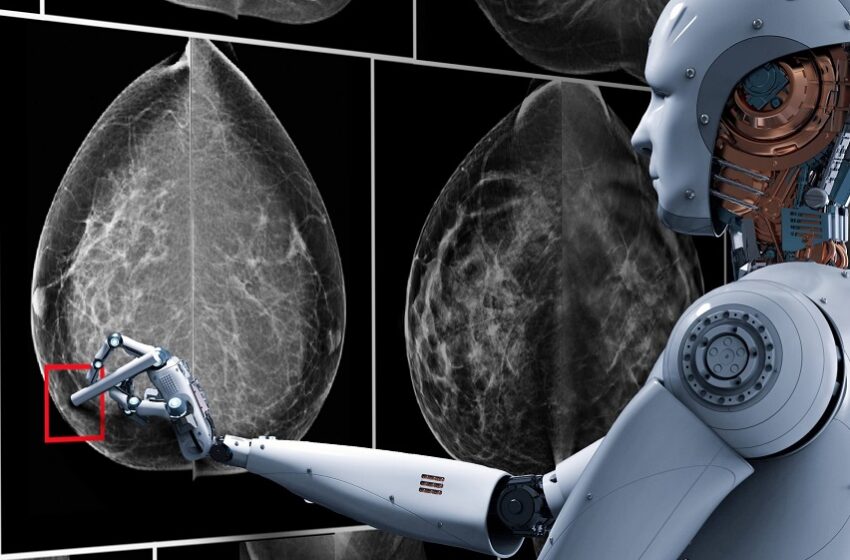  SPR lança desafio de IA para apoiar o diagnóstico do câncer de mama