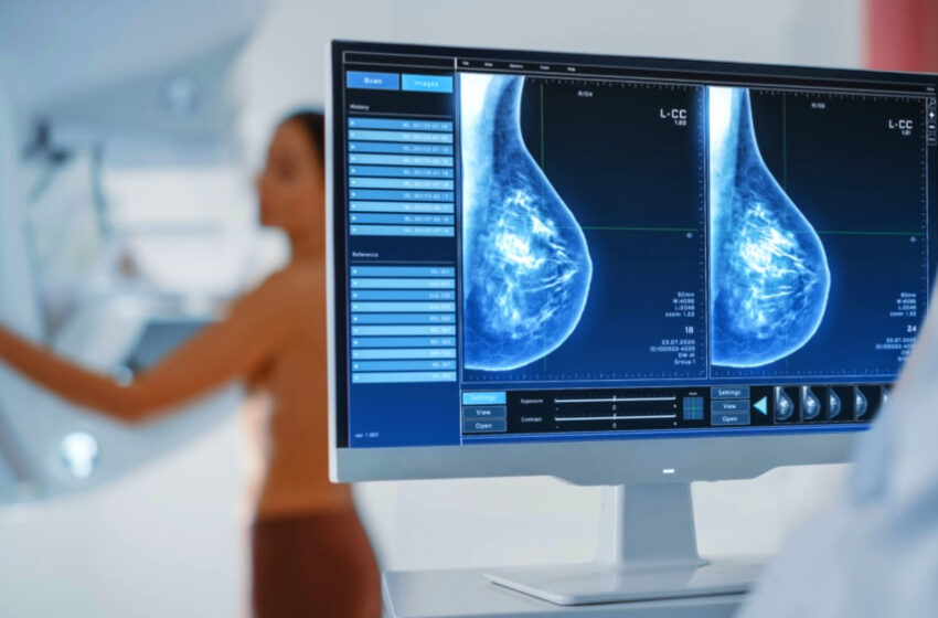 Câncer de mama: estudo inédito expõe desigualdades entre o SUS e a rede privada