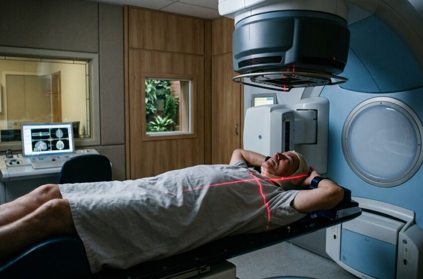  Radioterapia pode ser curativa em pacientes com câncer de esôfago inicial
