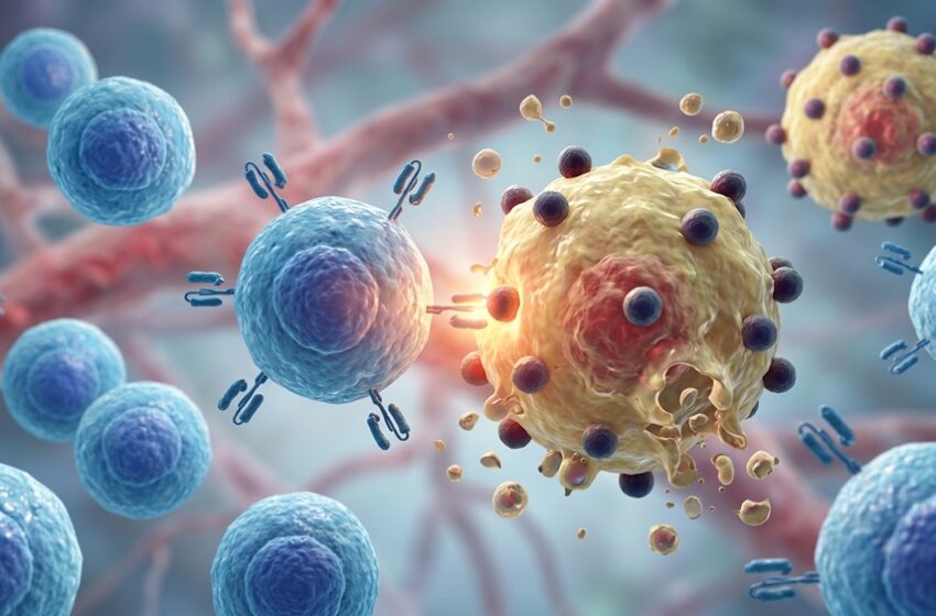  São Camilo realiza tratamento de Linfoma não Hodgkin com CAR-T cell